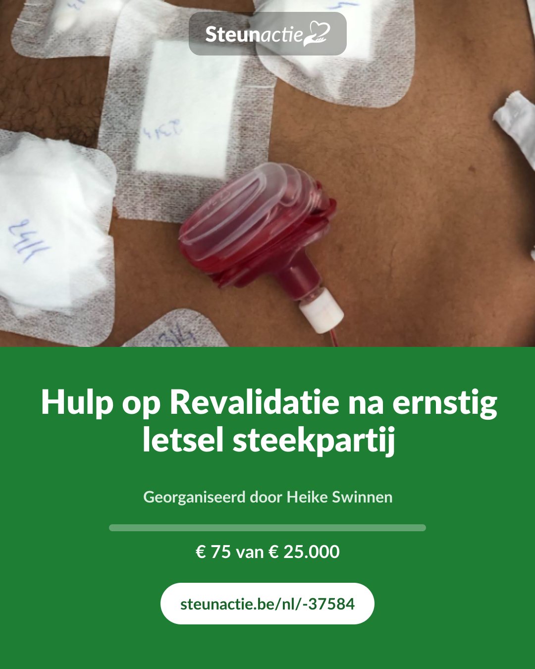 Voorbeeld van de afbeelding
