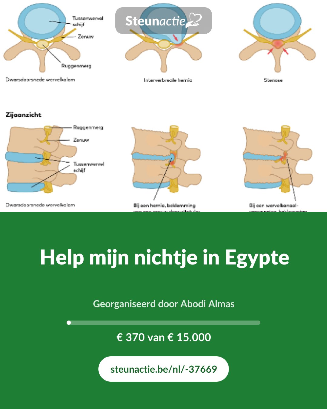 Voorbeeld van de afbeelding