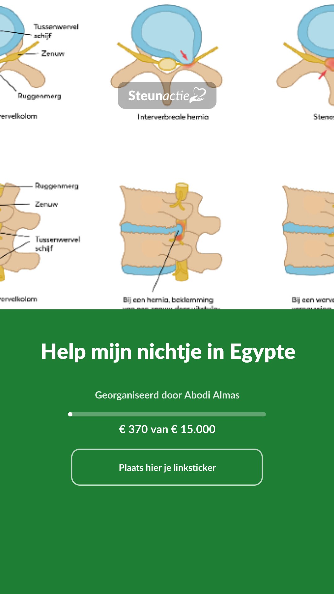 Voorbeeld van de afbeelding