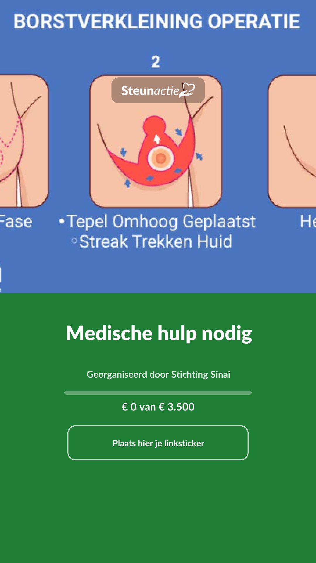 Voorbeeld van de afbeelding