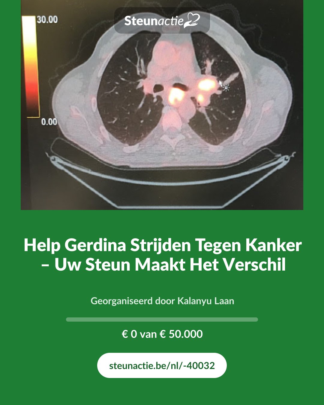 Voorbeeld van de afbeelding