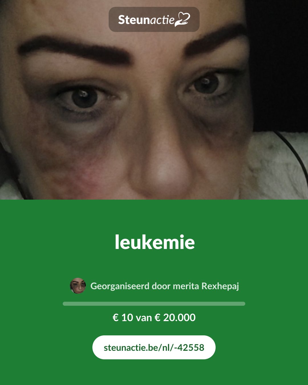 Voorbeeld van de afbeelding