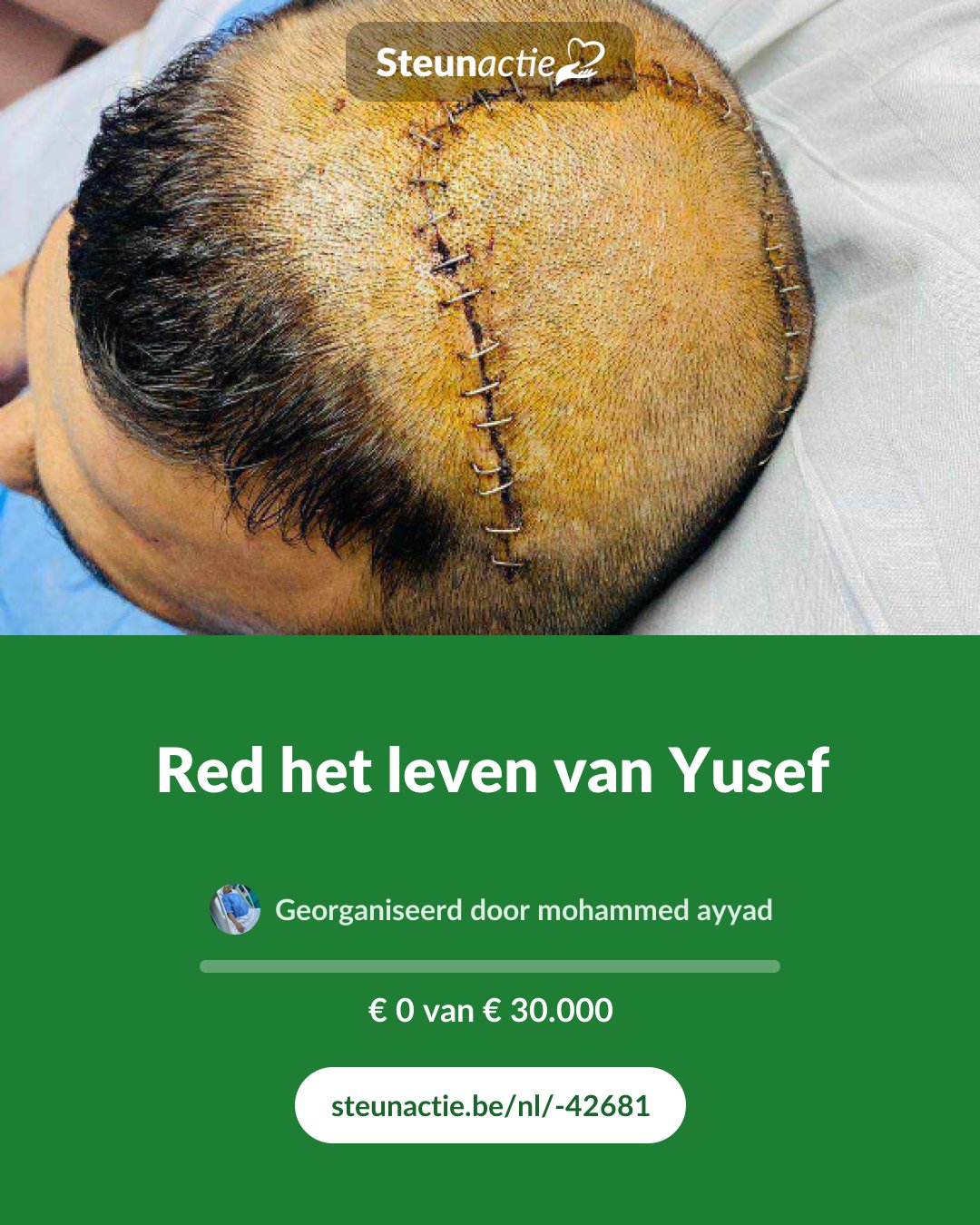 Voorbeeld van de afbeelding