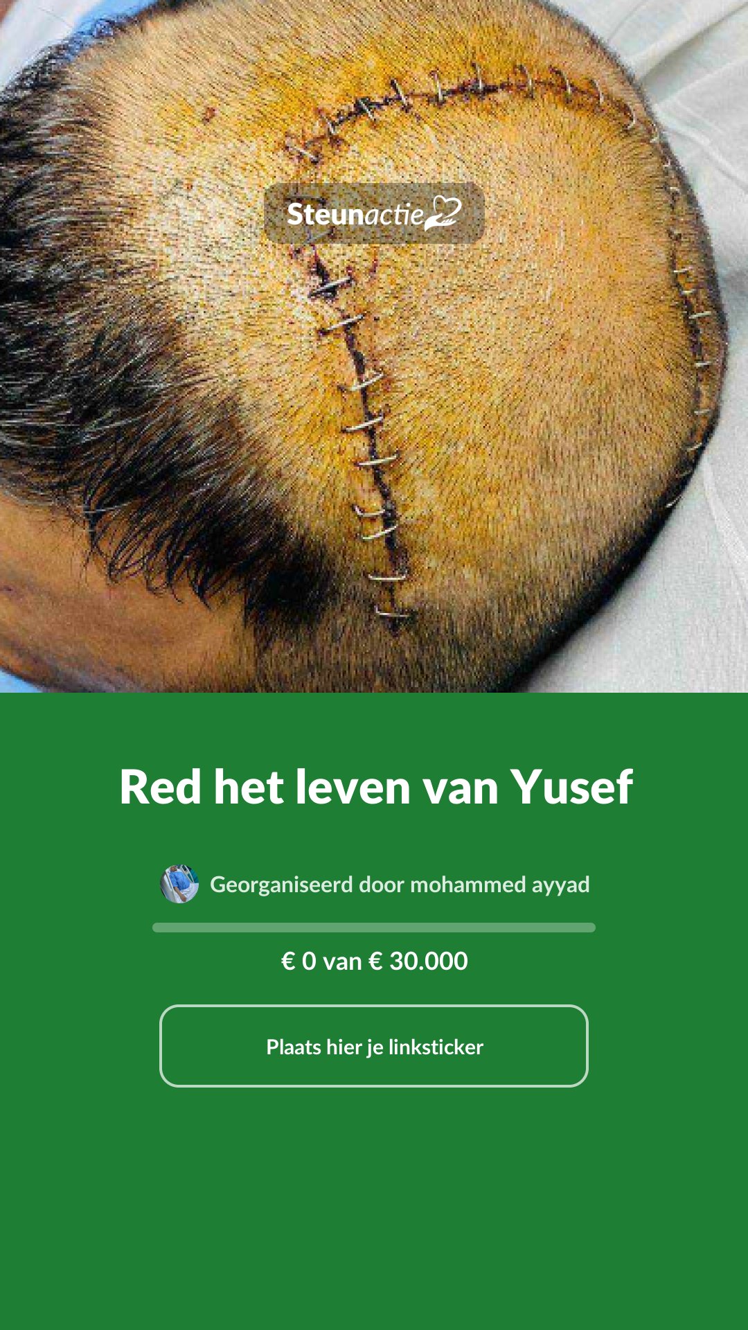 Voorbeeld van de afbeelding