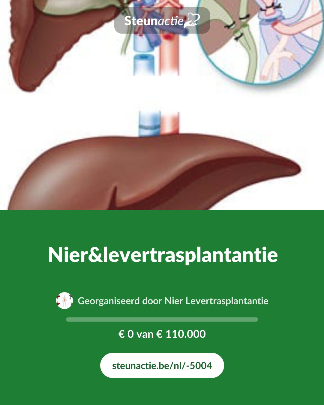 Voorbeeld van de afbeelding
