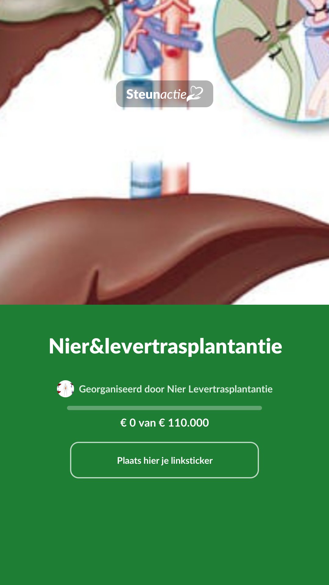 Voorbeeld van de afbeelding