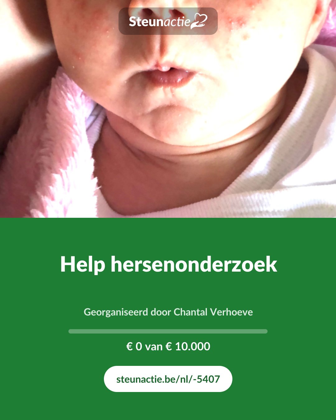 Voorbeeld van de afbeelding