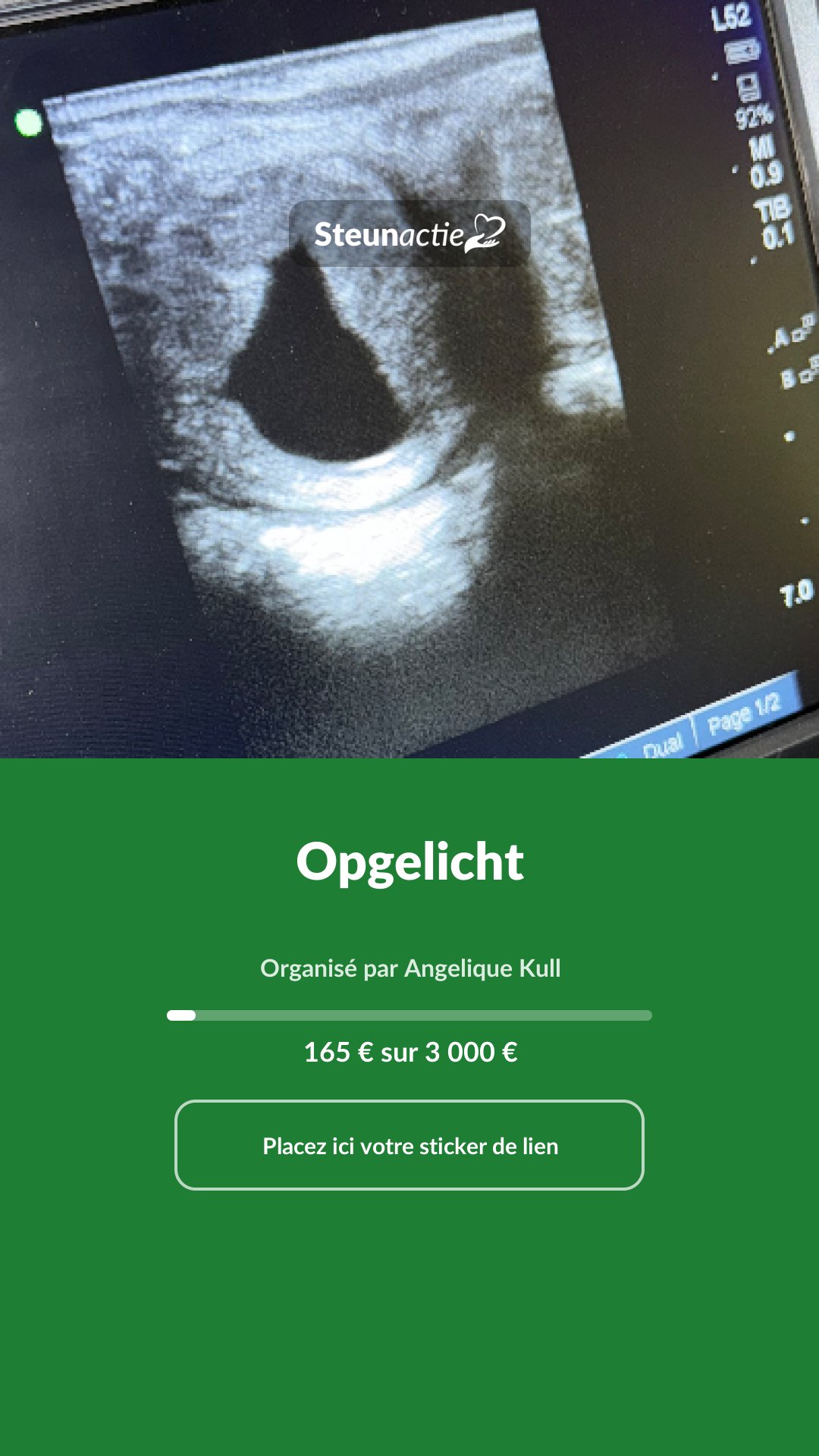 Aperçu de l'image