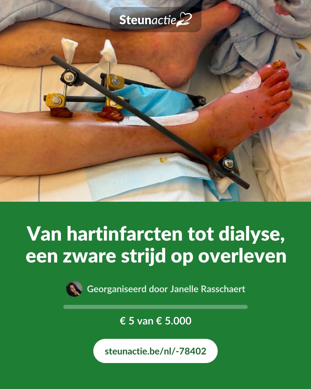 Voorbeeld van de afbeelding