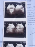 a62342c9 26d2 47bf 8a9a 62d3396386ea