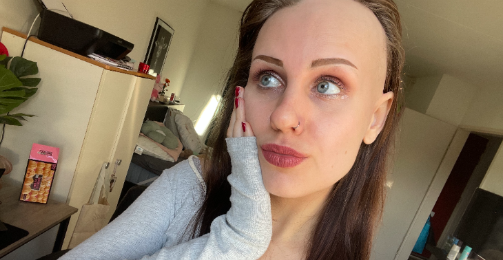 Steun mij bij het kopen van een pruik door Alopecia