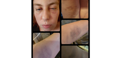 Help mij herstellen na een gewelds en afpersingsincident