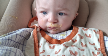 Microtie oor van onze pasgeboren baby Bowie en verdere gezondheidsproblemen