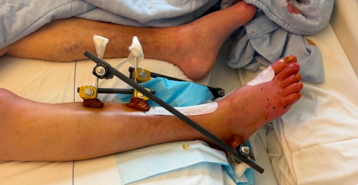 Van hartinfarcten tot dialyse, een zware strijd op overleven